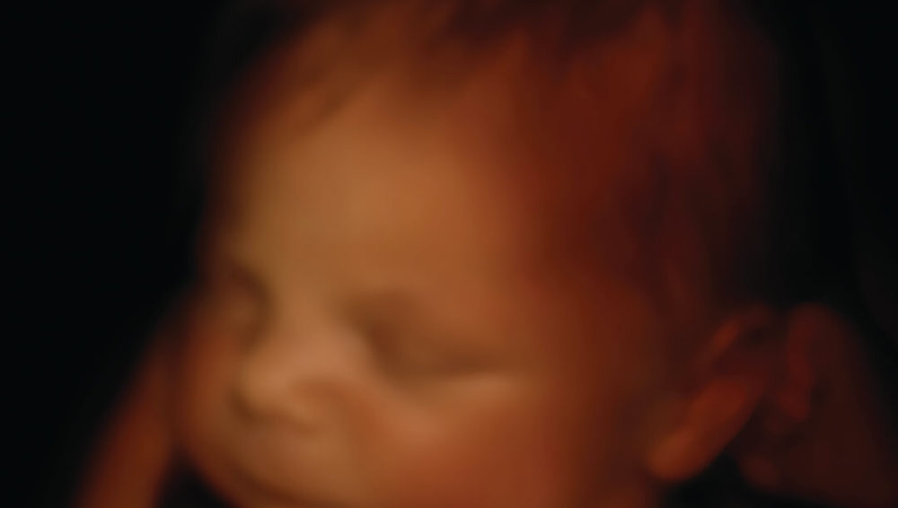 How does the little one sleep inside the womb?