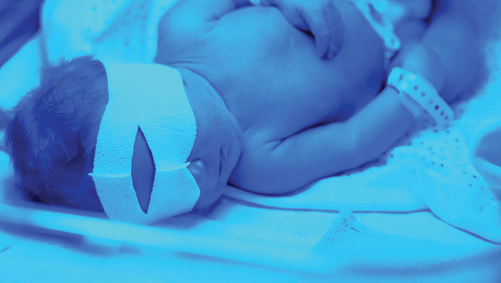 Understanding why your child might turn yellow after birth
