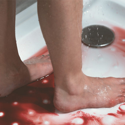 Bleeding after childbirth