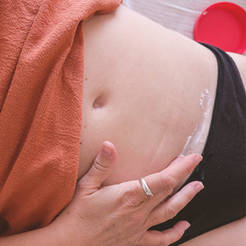 C-section healing: how to treat your scar