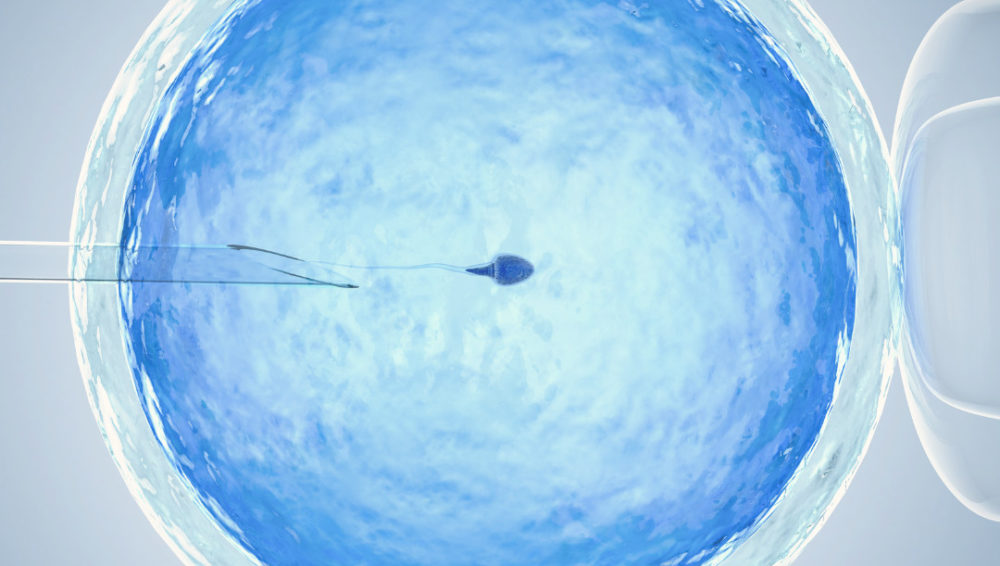 Understanding IVF: key procedures, timelines, and success factors